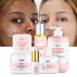 AILKE Glutathione & Vitamin C Kit